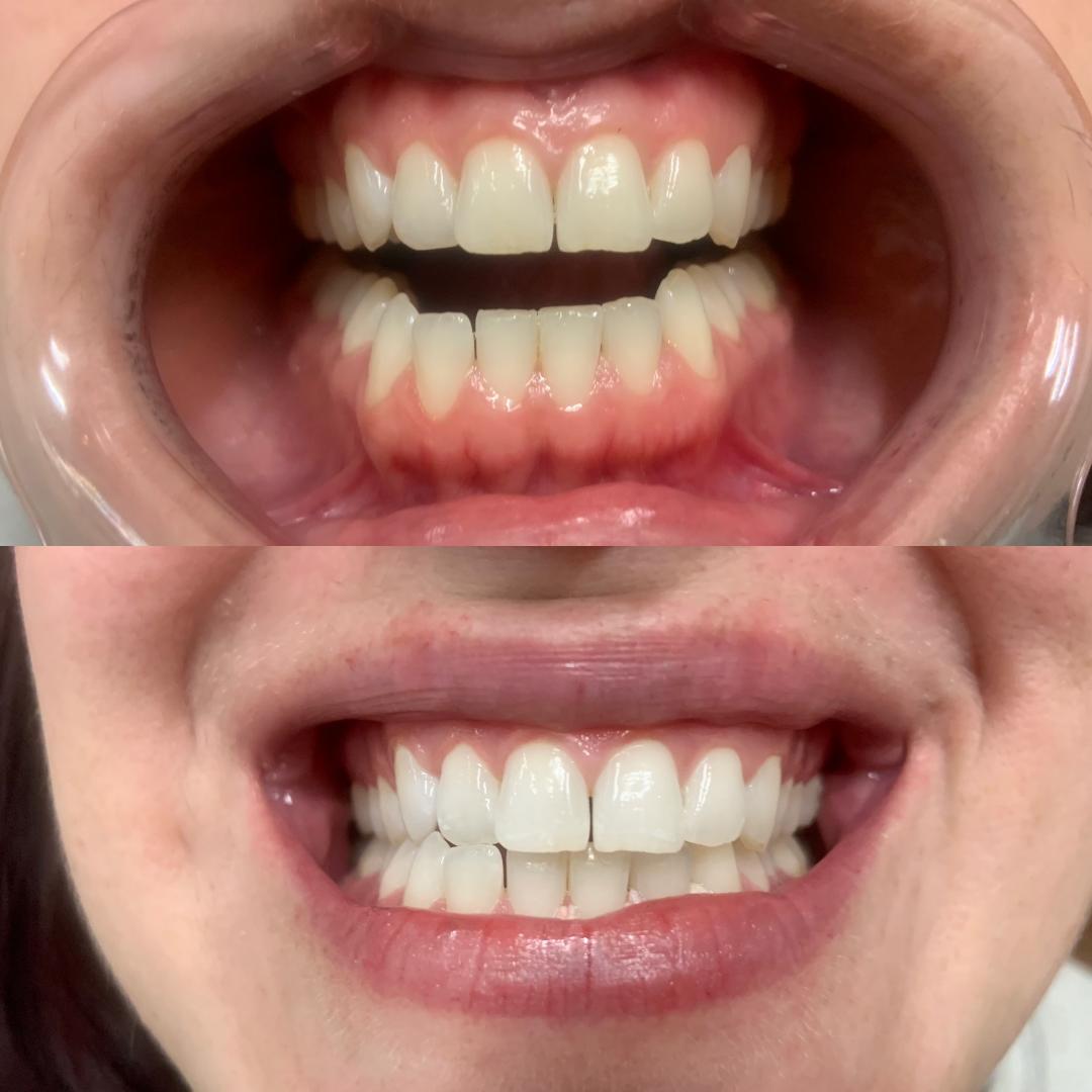 Spray Tan Services D.C., northern VA Spray Tans by Stefani