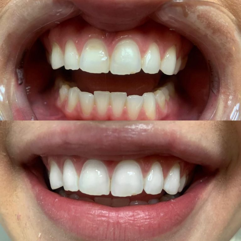 Spray Tan Services D.C., northern VA Spray Tans by Stefani